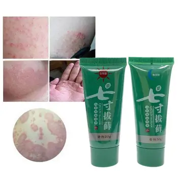 2Pcs/Set Krema za Luskavico Dan & Noč Telo Dermatitis Eczematoid Ekcem Mazilo Kožo Zdravljenje Luskavice