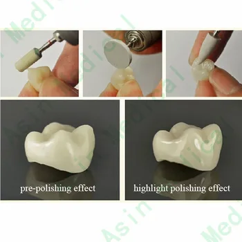 Zobni Poliranje Zob poljski Komplet Za Kompozitne 12PCS RA0312D Ambulante Zobozdravnikov